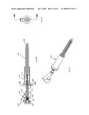 Apparatus and methods for bone, tissue and duct dilatation diagram and image