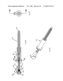 Apparatus and methods for bone, tissue and duct dilatation diagram and image