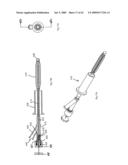 Apparatus and methods for bone, tissue and duct dilatation diagram and image