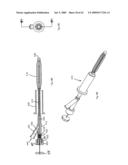 Apparatus and methods for bone, tissue and duct dilatation diagram and image