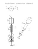 Apparatus and methods for bone, tissue and duct dilatation diagram and image