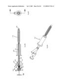 Apparatus and methods for bone, tissue and duct dilatation diagram and image