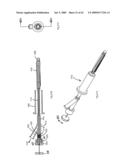 Apparatus and methods for bone, tissue and duct dilatation diagram and image