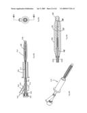 Apparatus and methods for bone, tissue and duct dilatation diagram and image