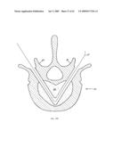 Apparatus and methods for bone, tissue and duct dilatation diagram and image