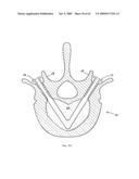 Apparatus and methods for bone, tissue and duct dilatation diagram and image