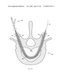 Apparatus and methods for bone, tissue and duct dilatation diagram and image