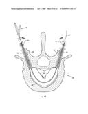 Apparatus and methods for bone, tissue and duct dilatation diagram and image