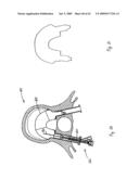 Apparatus and methods for bone, tissue and duct dilatation diagram and image