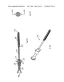 Apparatus and methods for bone, tissue and duct dilatation diagram and image