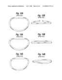 Degenerative Valvular Disease Specific Annuloplasty Rings diagram and image