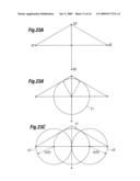 Degenerative Valvular Disease Specific Annuloplasty Rings diagram and image