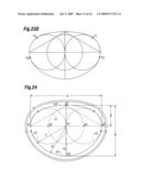 Degenerative Valvular Disease Specific Annuloplasty Rings diagram and image