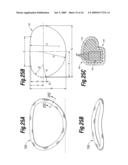 Degenerative Valvular Disease Specific Annuloplasty Rings diagram and image