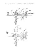 IMPLANTATION SYSTEM FOR ANNULOPLASTY RINGS diagram and image