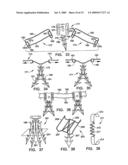 IMPLANTATION SYSTEM FOR ANNULOPLASTY RINGS diagram and image