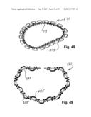 IMPLANTATION SYSTEM FOR ANNULOPLASTY RINGS diagram and image