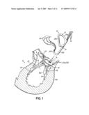 HEART VALVE REPAIR APPARATUS AND METHODS diagram and image