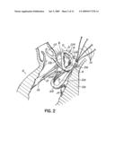 HEART VALVE REPAIR APPARATUS AND METHODS diagram and image