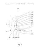 Extended Decompression Flap Arrangement diagram and image