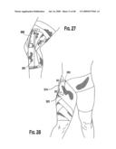 VIBRATION DAMPENING MATERIAL AND METHOD OF MAKING SAME diagram and image