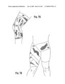 VIBRATION DAMPENING MATERIAL AND METHOD OF MAKING SAME diagram and image