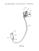 Tilt control mechanism for a chair diagram and image