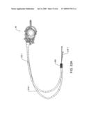 Tilt control mechanism for a chair diagram and image