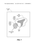 CARDIAC TARGET TRACKING diagram and image