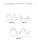 CARDIAC TARGET TRACKING diagram and image