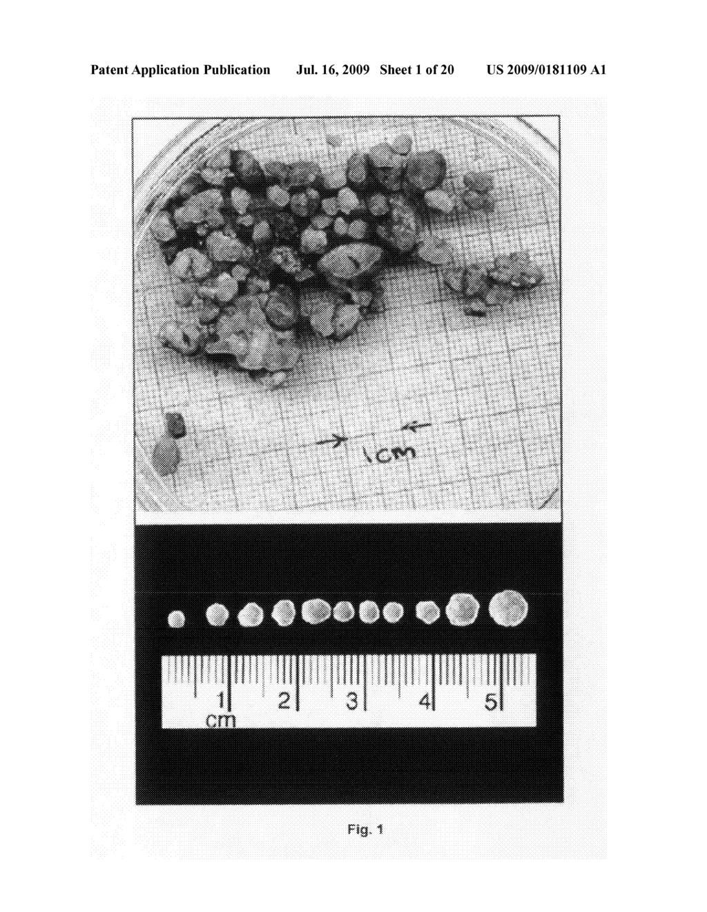 Nanoveson.TM.: treatment, biomarkers and diagnostic tests for liver diseases and comorbid diseases - diagram, schematic, and image 02