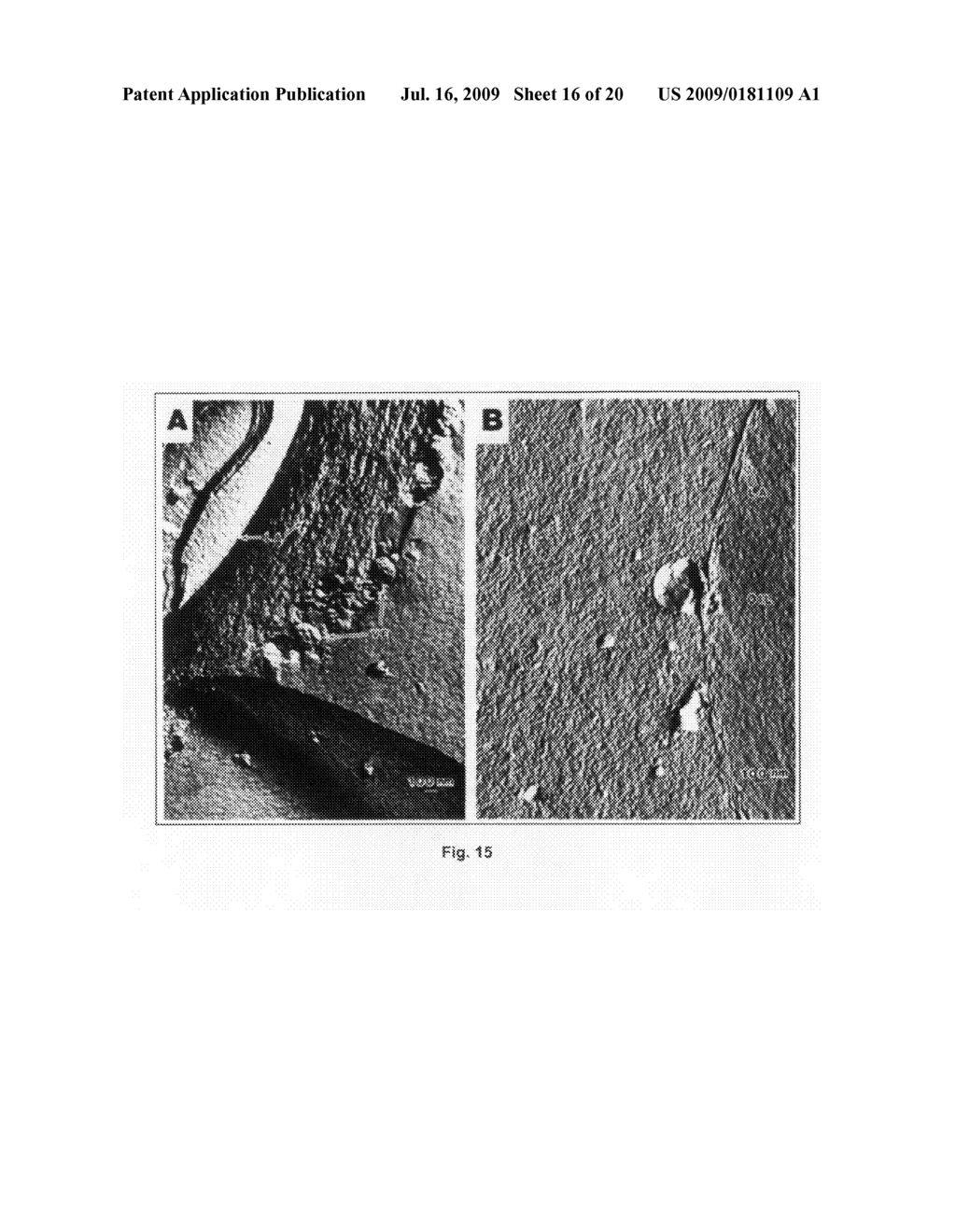 Nanoveson.TM.: treatment, biomarkers and diagnostic tests for liver diseases and comorbid diseases - diagram, schematic, and image 17