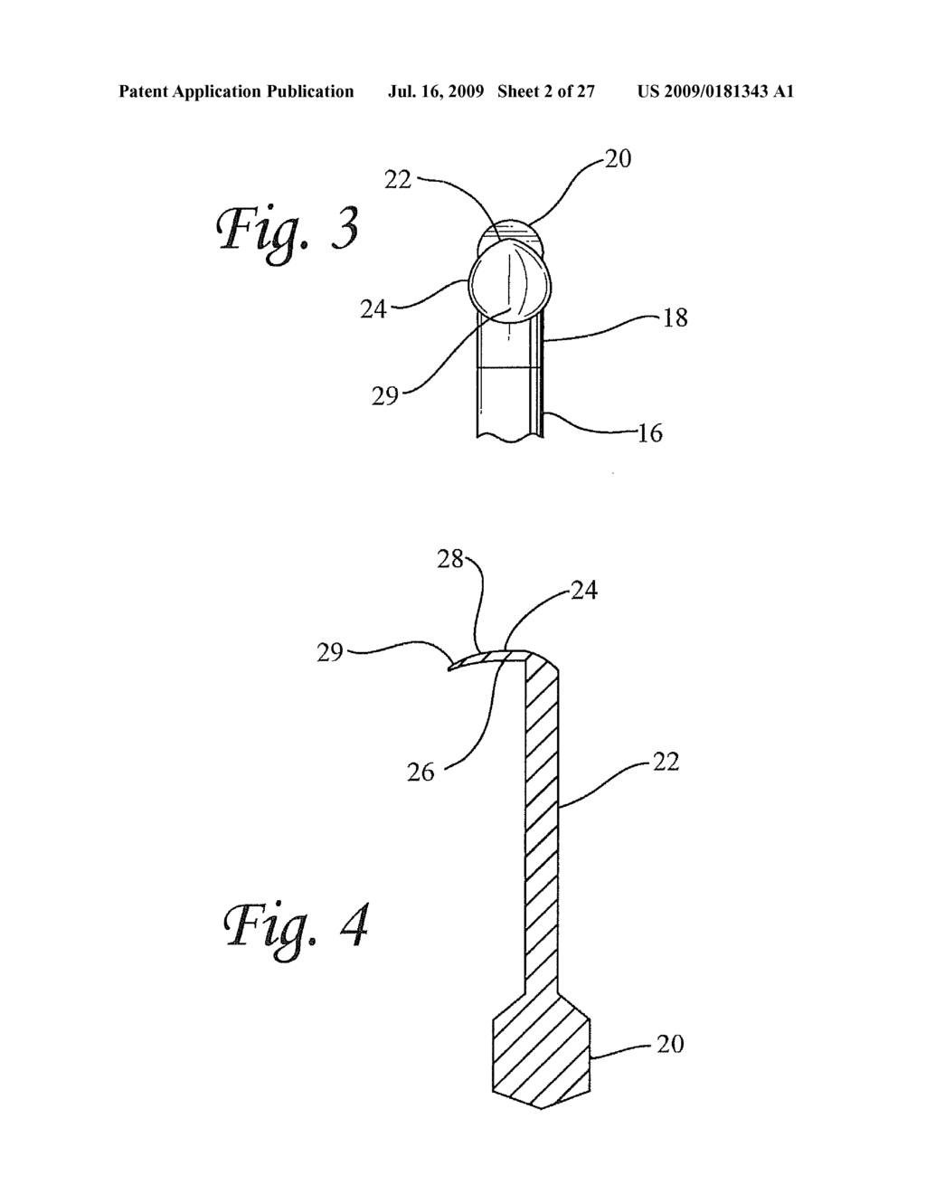 Flexible tooling for use in maxillary sinus elevation procedures and method of using the same - diagram, schematic, and image 03