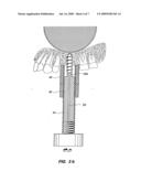 ASSEMBLY FOR LIFTING THE SINUS MEMBRANE FOR USE IN DENTAL IMPLANT SURGERY diagram and image