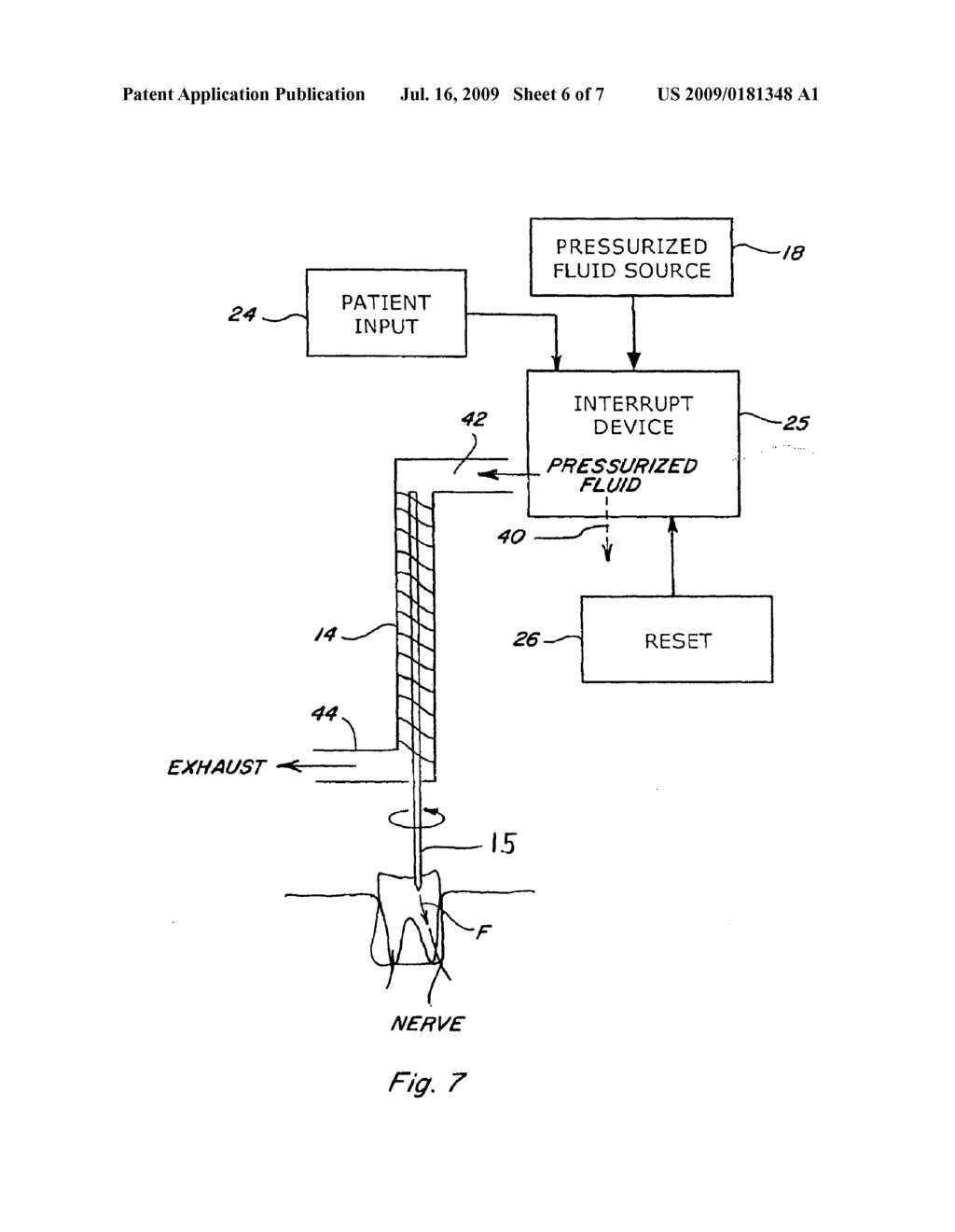 DENTAL PATIENT ANXIETY AND PAIN MANAGEMENT SYSTEM INCLUDING ISOLATED HAND PIECE INTERRUPT AND RESET - diagram, schematic, and image 07