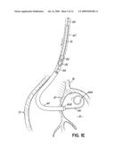 DEVICES, METHODS AND SYSTEMS FOR ESTABLISHING SUPPLEMENTAL BLOOD FLOW IN THE CIRCULATORY SYSTEM diagram and image