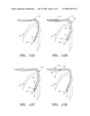 EXPANDABLE GUIDE SHEATH AND APPARATUS AND METHODS FOR USING SUCH SHEATHS diagram and image