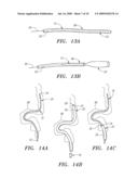 EXPANDABLE GUIDE SHEATH AND APPARATUS AND METHODS FOR USING SUCH SHEATHS diagram and image