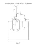 Cryosurgical System diagram and image