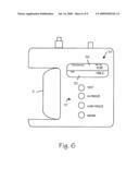 Cryosurgical System diagram and image