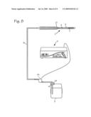 Cryosurgical System diagram and image