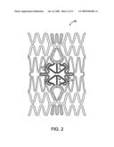 STENT WITH SELF-DEPLOYABLE PORTION HAVING WINGS OF DIFFERENT LENGTHS diagram and image