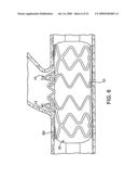 STENT WITH SELF-DEPLOYABLE PORTION HAVING WINGS OF DIFFERENT LENGTHS diagram and image