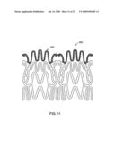 STENT WITH SELF-DEPLOYABLE PORTION HAVING WINGS OF DIFFERENT LENGTHS diagram and image