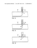 STENT WITH SELF-DEPLOYABLE PORTION HAVING WINGS OF DIFFERENT LENGTHS diagram and image