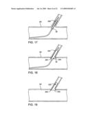 STENT WITH SELF-DEPLOYABLE PORTION HAVING WINGS OF DIFFERENT LENGTHS diagram and image