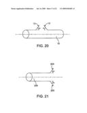 STENT WITH SELF-DEPLOYABLE PORTION HAVING WINGS OF DIFFERENT LENGTHS diagram and image