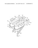 Total joint Replacement diagram and image