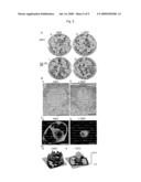 Use of histone chaperone activity of agrobacterium 6b protein diagram and image