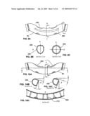 METHODS AND DEVICES FOR IMPROVING EFFICACY OF NON-INVASIVE VENTILATION diagram and image